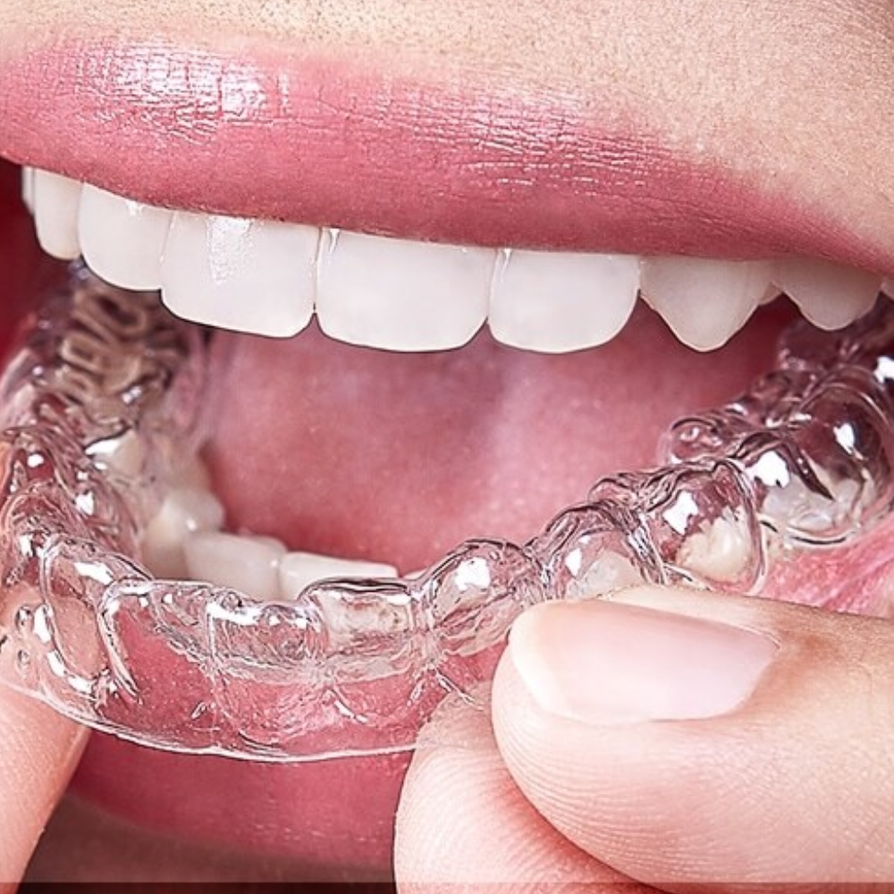 Root Canal Specialist in Mahalaxmi Nagar Indore