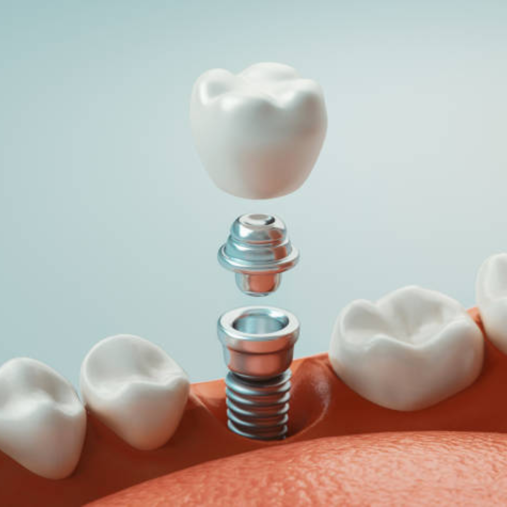 Dentist Near Me in Mahalaxmi Nagar Indore