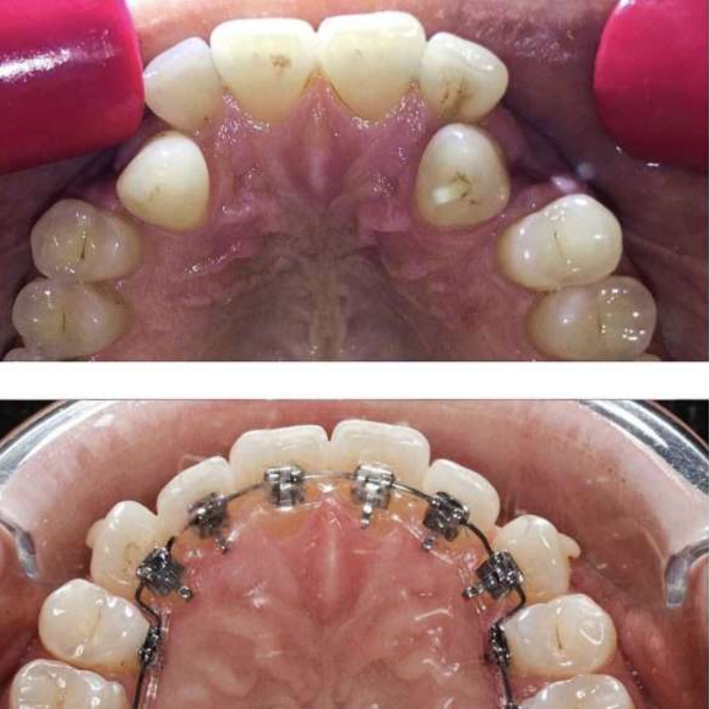 Affordable Dental Clinic in Mahalaxmi Nagar Indore